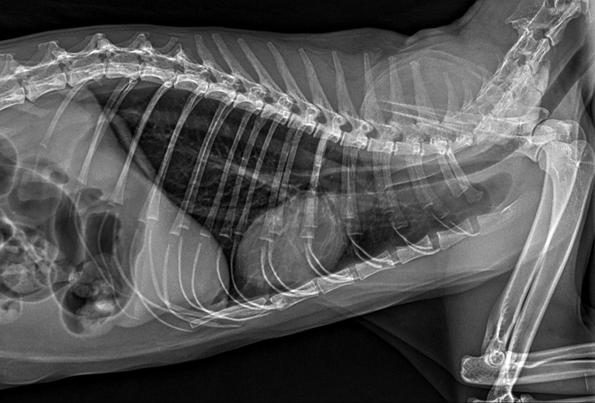 Radiografia de tórax em projeção laterolateral (exame real anonimizado)